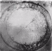 Royal Rife Cross-section of Single tetanus