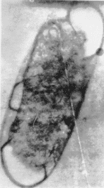 Rife Micrograph of Bacillus Typhosus