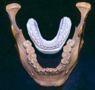 Comparison jaws