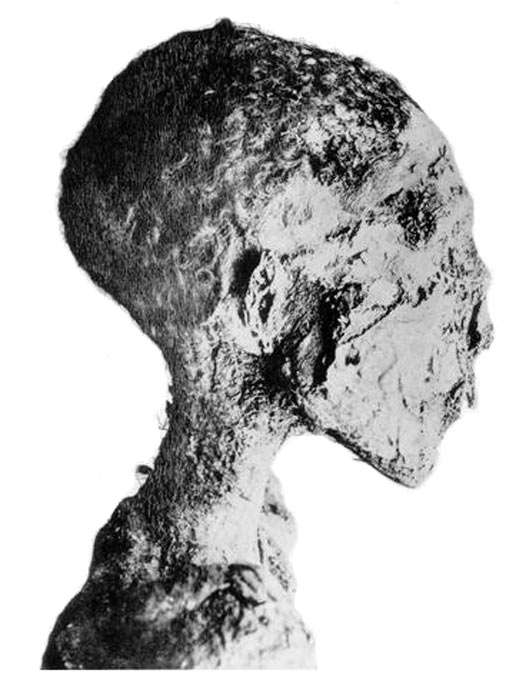 Mummy head of Siptah.