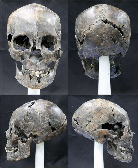 elongated skull from South korea
