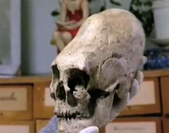 Omsk elongated skull