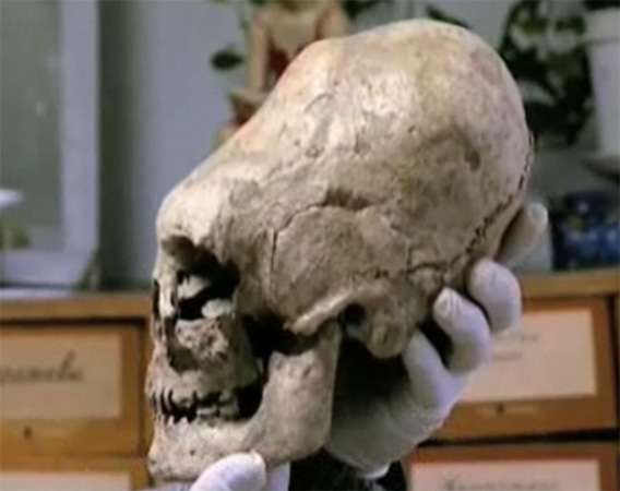 Omsk elongated skull