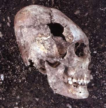 Gothic skull, 4th century, Globasnitz