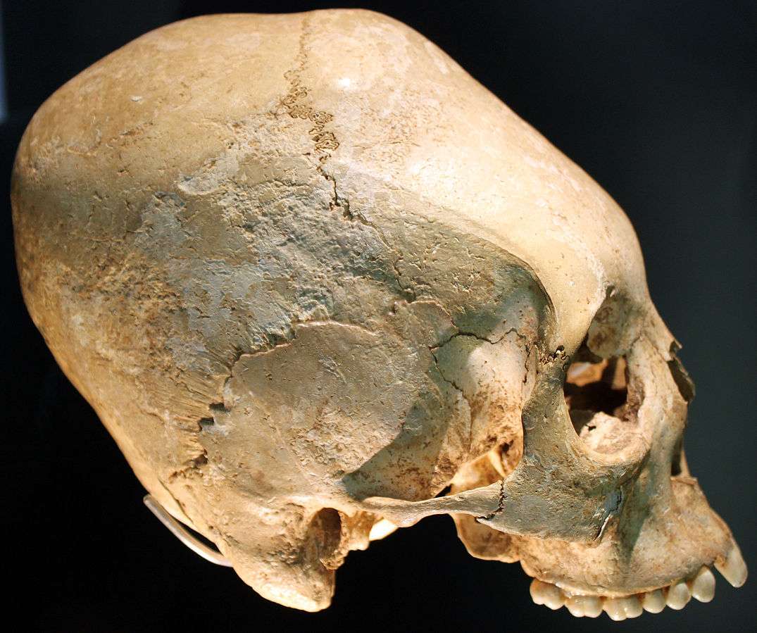Württemberg skull