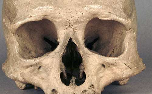 eye sockets of a normal human