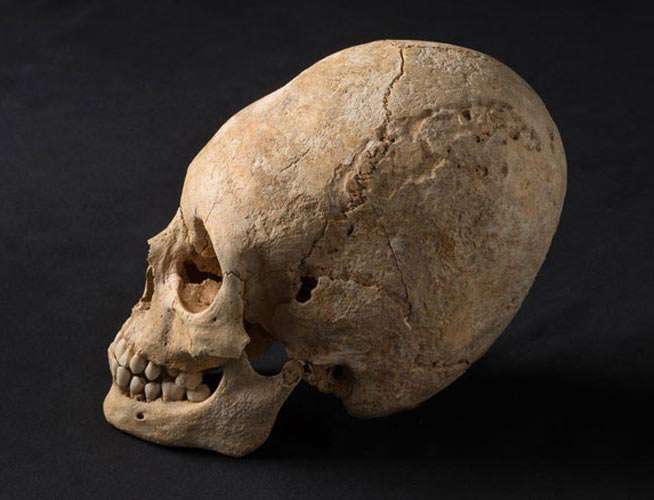 Elonated skull at Obernai , France