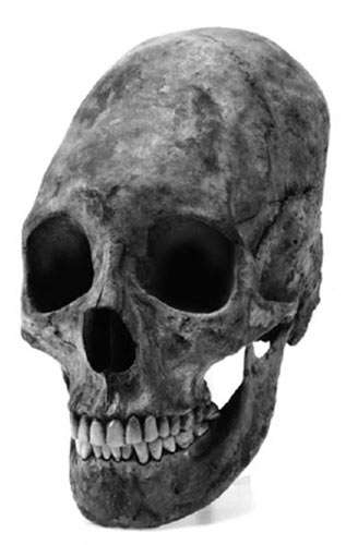 elongated skull at Altenerding