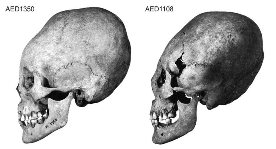 elongated skulls at Altenerding