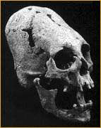 Burgobiab skull