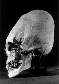 Pontoise skull
