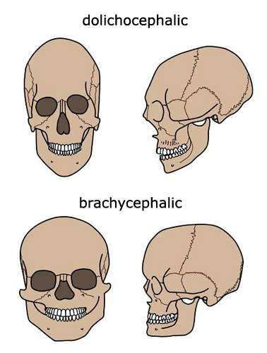 Comparison between elongated and round skull types