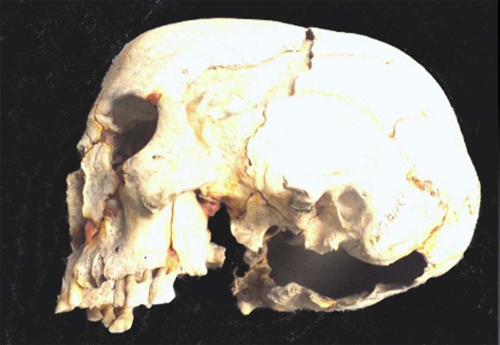 The Tilshead long skull of a woman