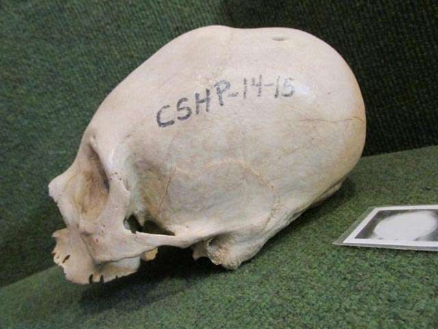 Lake Titicaca child skull