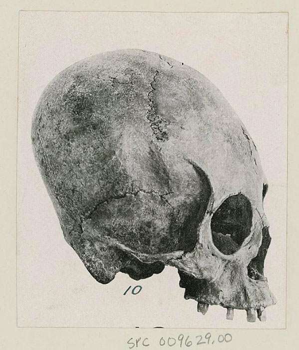 Diaguita Skull from Argentina