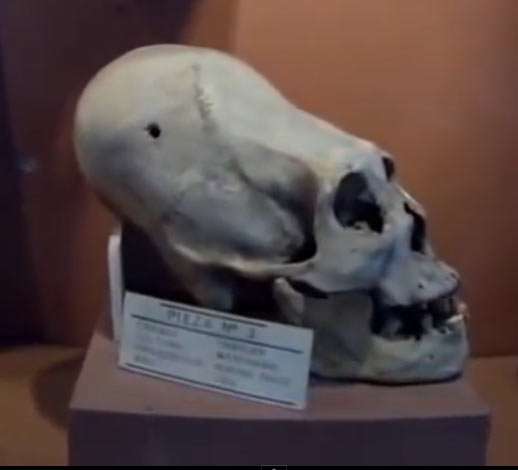 Bolivia elongated skull