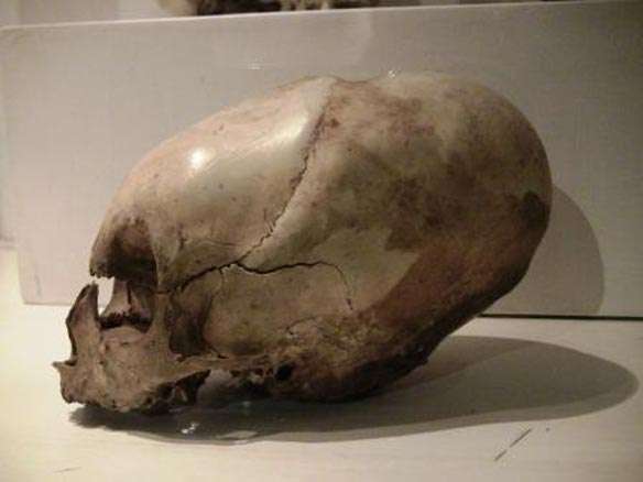 Cusco skull