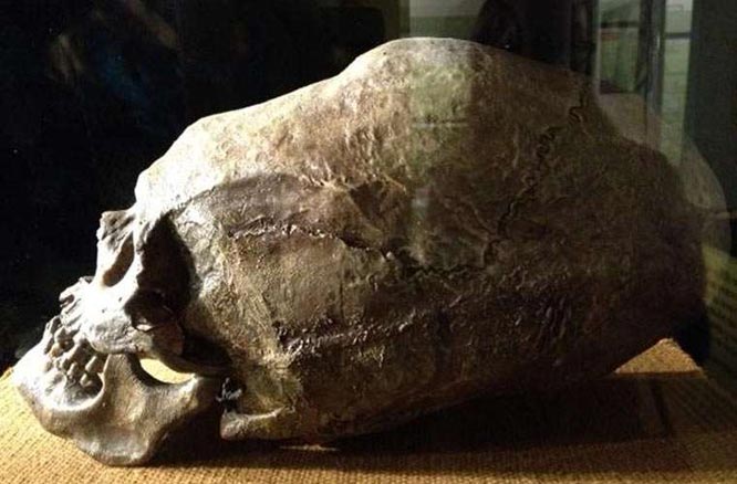 elongated skull from Cusco