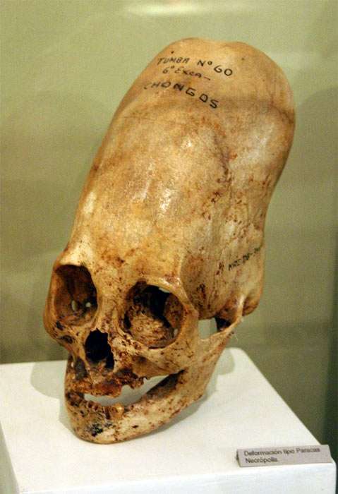 elongated skull from Ica