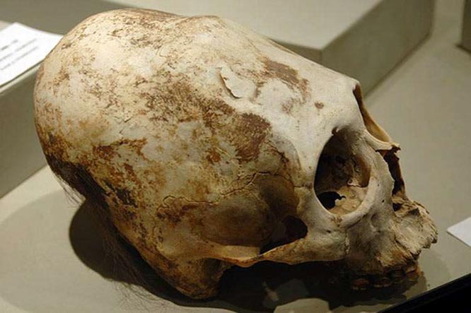elongated skull in Ica museum