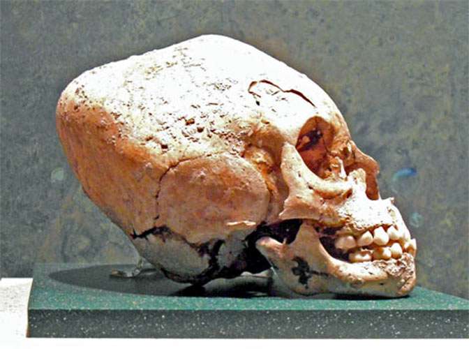 elongated skull in Mexico