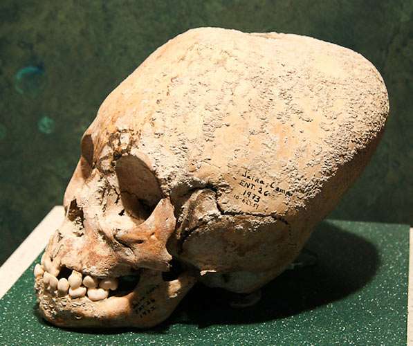 Mexico elongated skull
