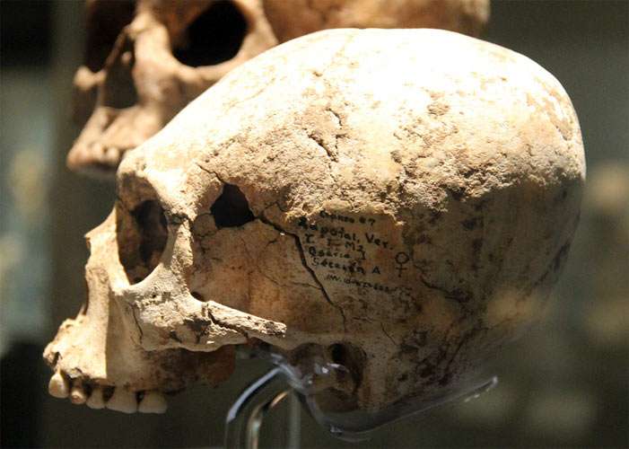 elongated skull at INAH, National Museum of Anthropology, Mexico City