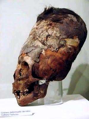 Paracas skull