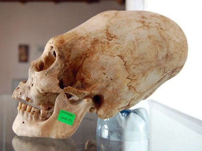elongated Paracas skull
