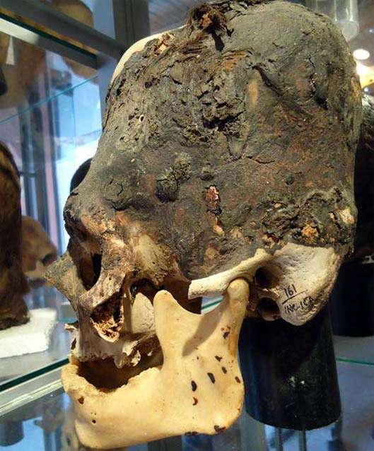 Paracas skull