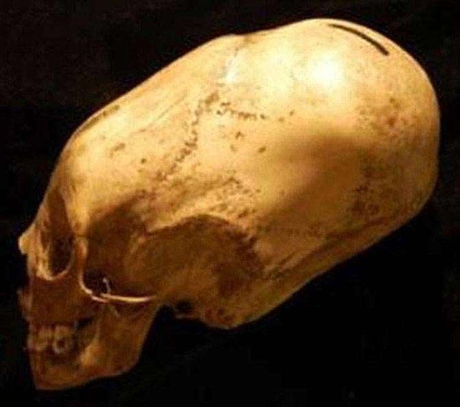 Paracas skull