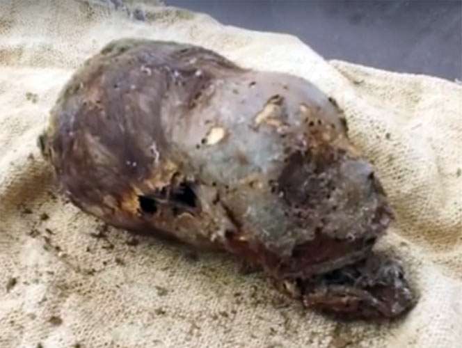 three month old baby skull with elongated head