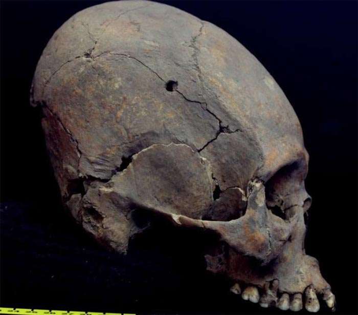 Teotihuacan skull
