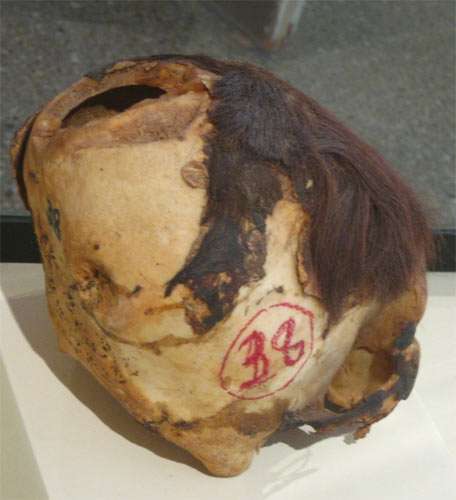 trepanned skull from Ica, Peru